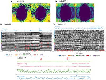 Quality control in functional MRI studies with MRIQC and fMRIPrep